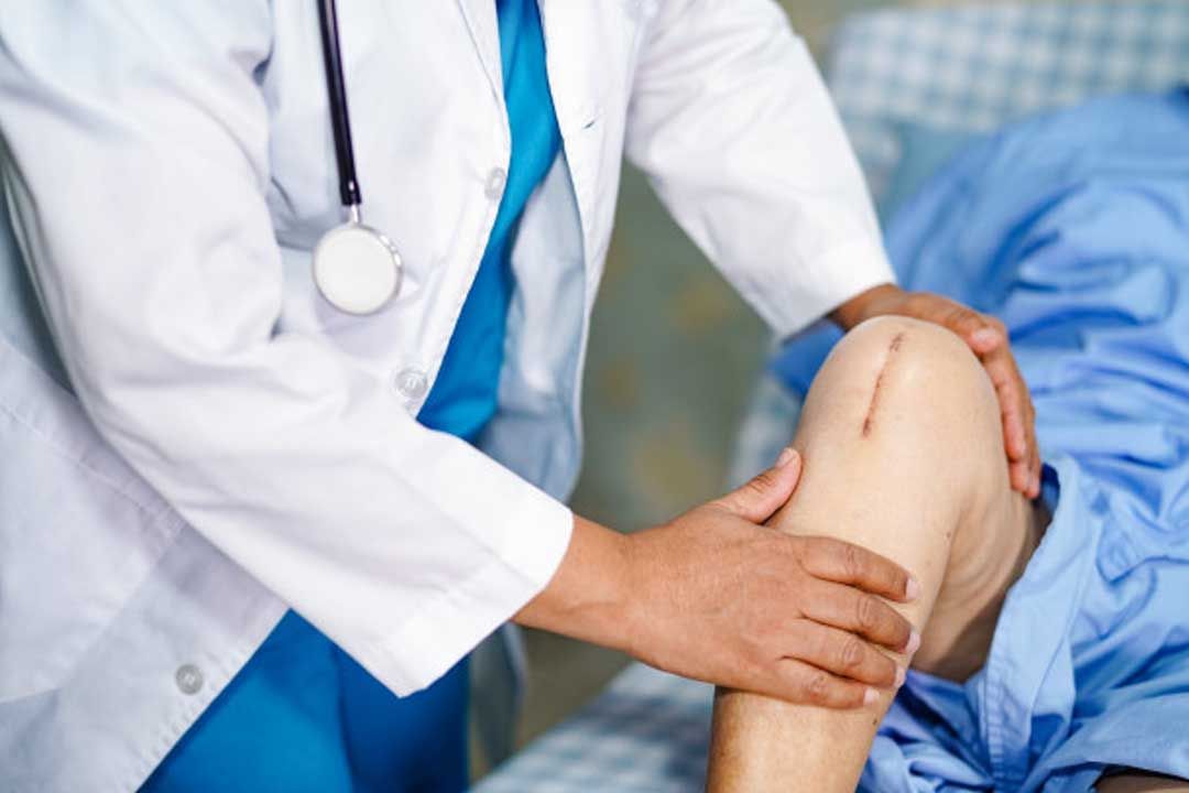 Major Reliable Knee Replacement Alternatives