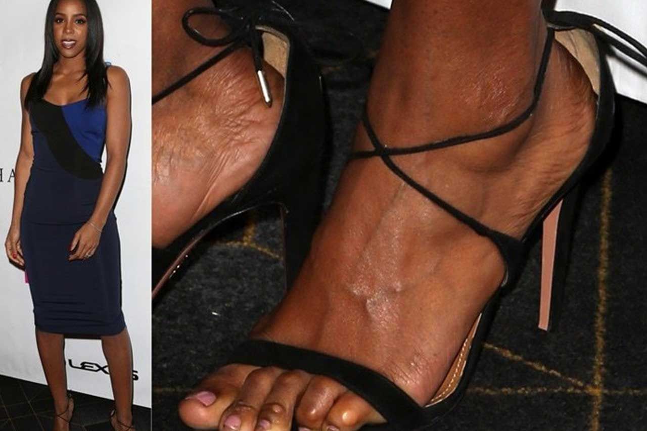 celebrities with bad feet
