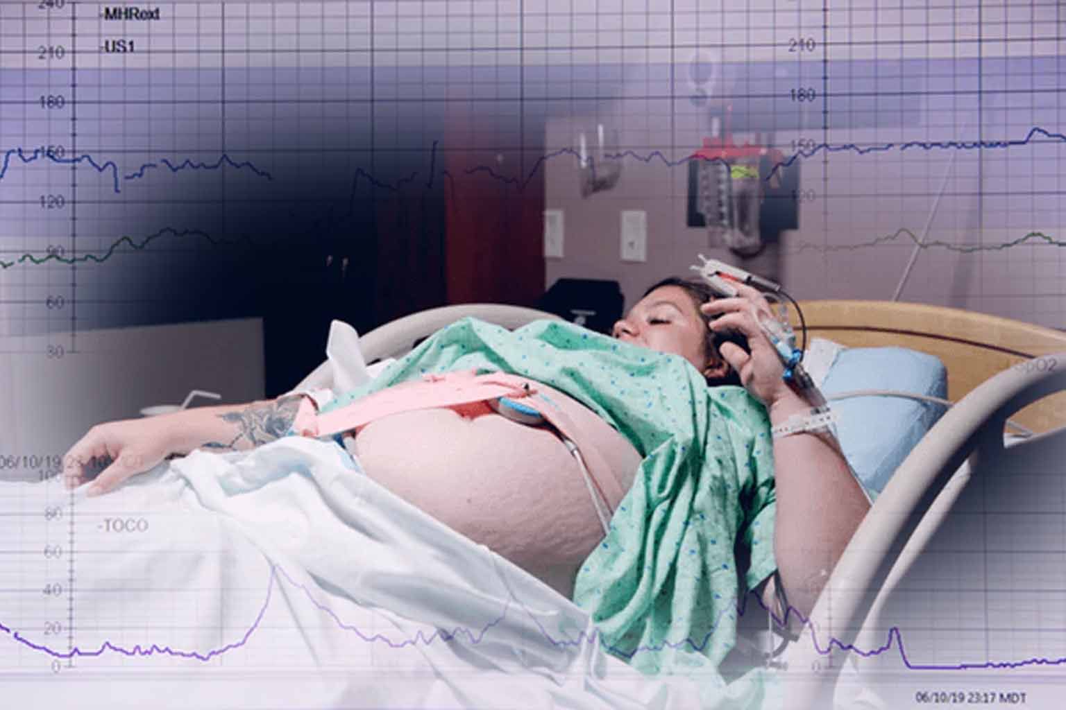 fetal monitor in pregnancy