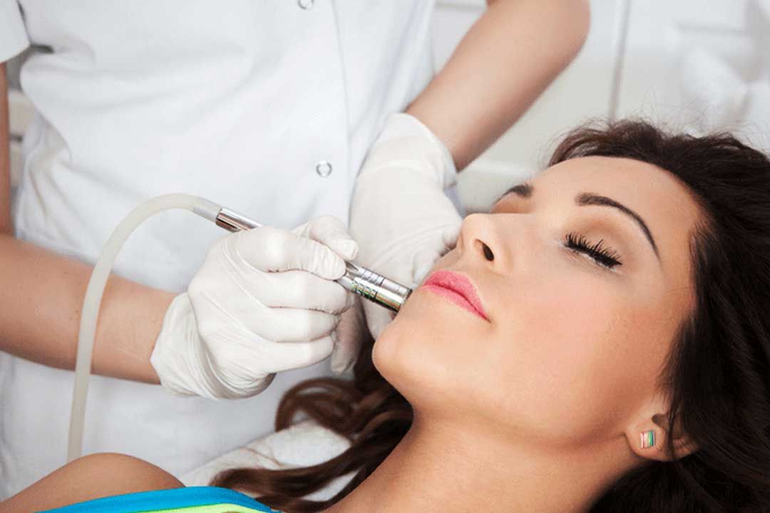 Everything You Should Know About Laser Resurfacing 
