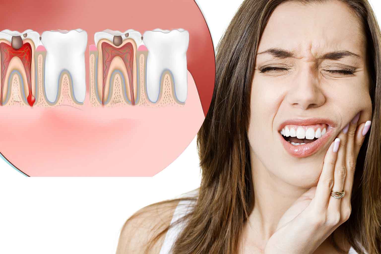 Best Home Remedies for Treatment of Toothache