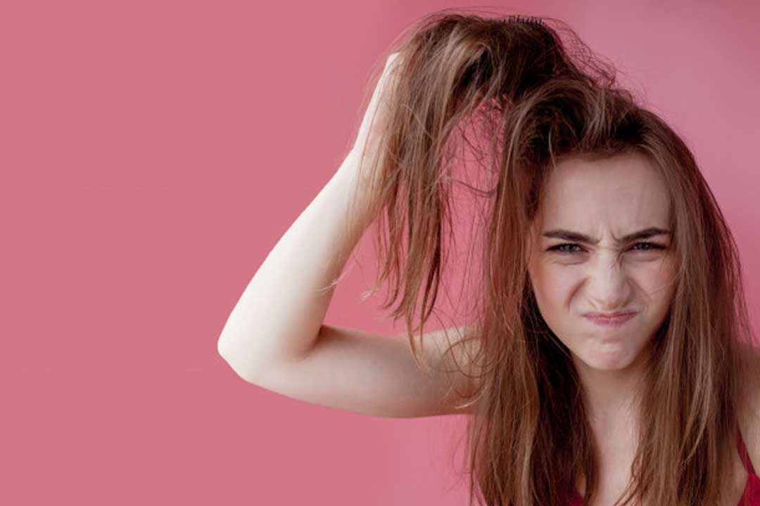 8 Amazing Tips to Get Rid of Greasy Hairs 