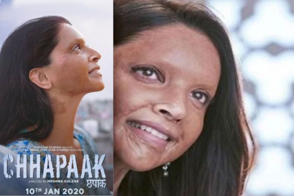 Chhapaak acid attack victim's story