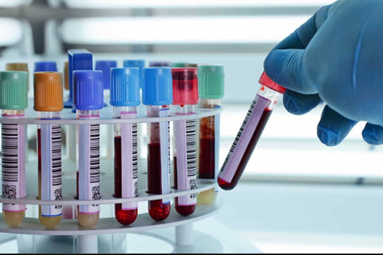 things to know about blood test