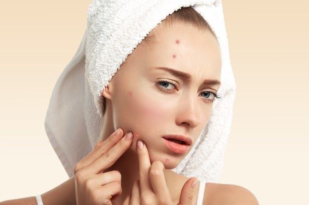 3 Top Acne Treatments