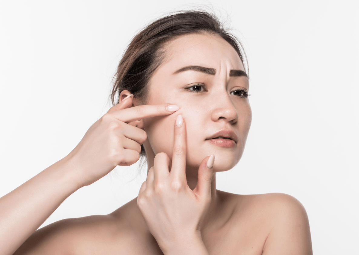 Remedies to Remove Skin Tags
