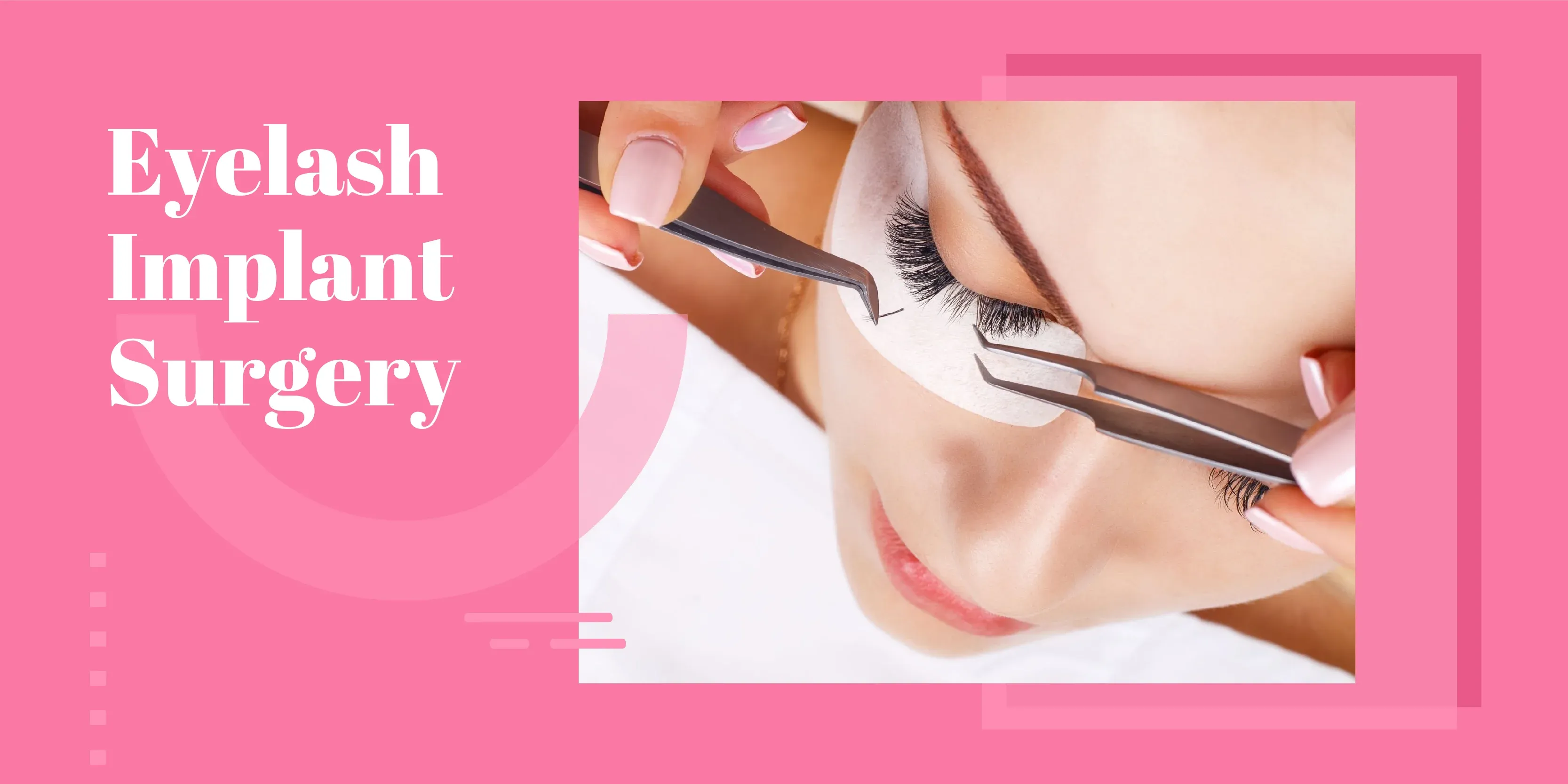 Eyelash Implant Surgery