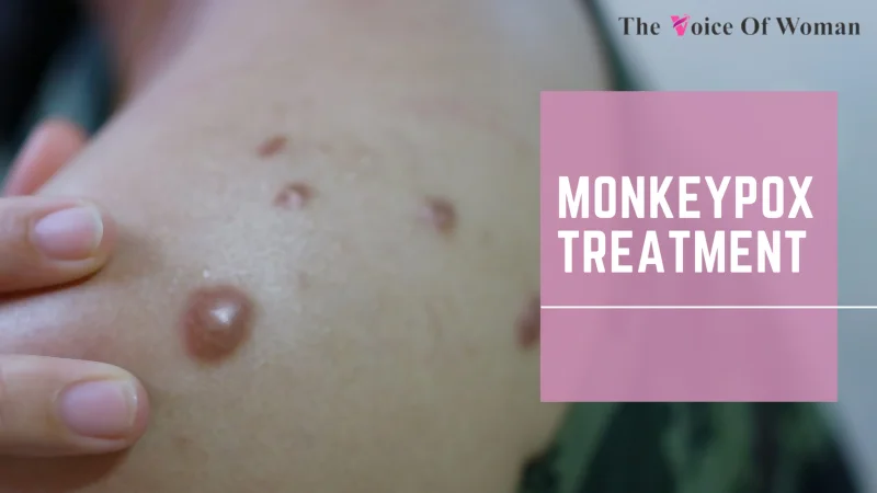 Monkeypox Scars
