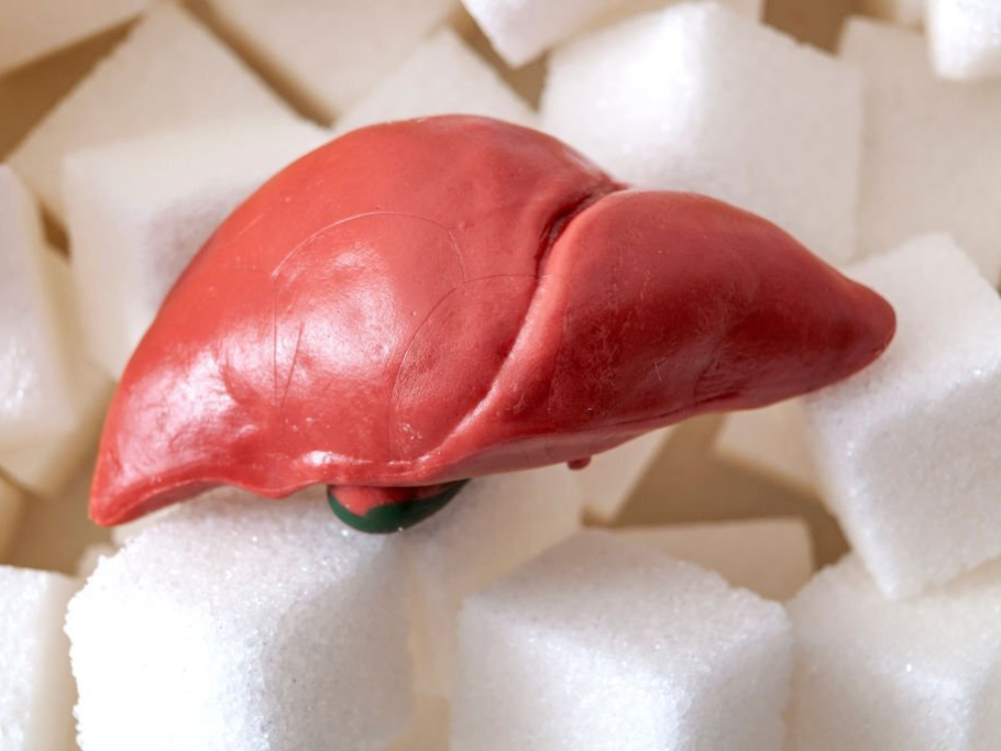 Side Effects of High Sugar Intake On Liver