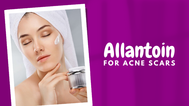 Allantoin Cream For Skin